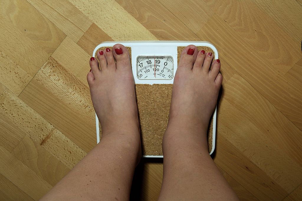 An anonymous woman, 42, on the scales before her weight loss surgery. The scales stop at 19 stone, but she weighs nearly 20 stone (126kg) and is severely obese.