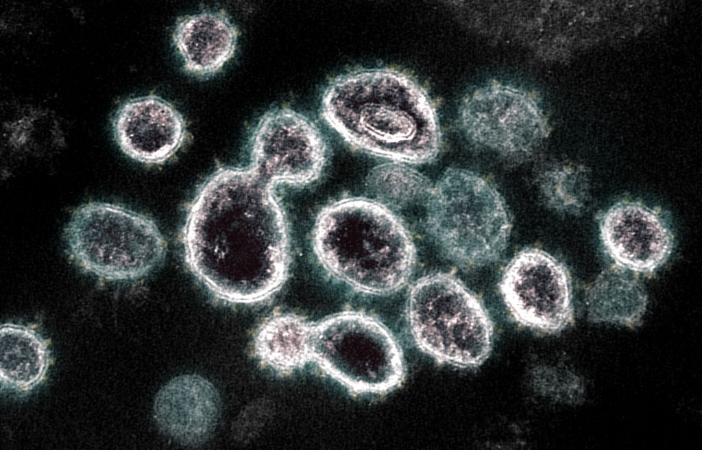 This transmission electron microscope image shows SARS-CoV-2, the virus that causes COVID-19, isolated from a patient in the U.S.